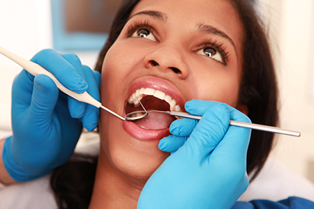 Angela Laithangbam, DDS Inc. | Bioclear Dentistry, Intraoral Camera and Oral Exams